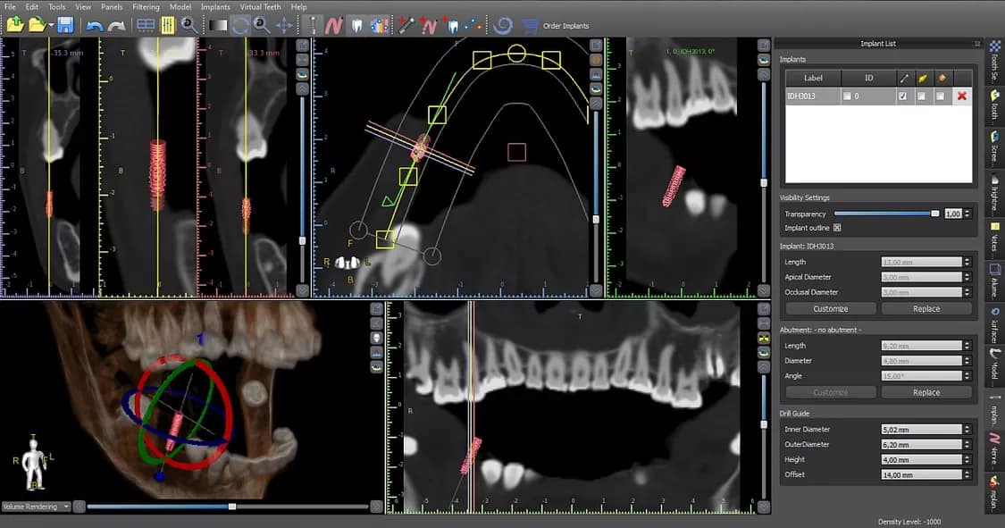 シミュレーション