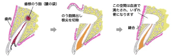 イラスト